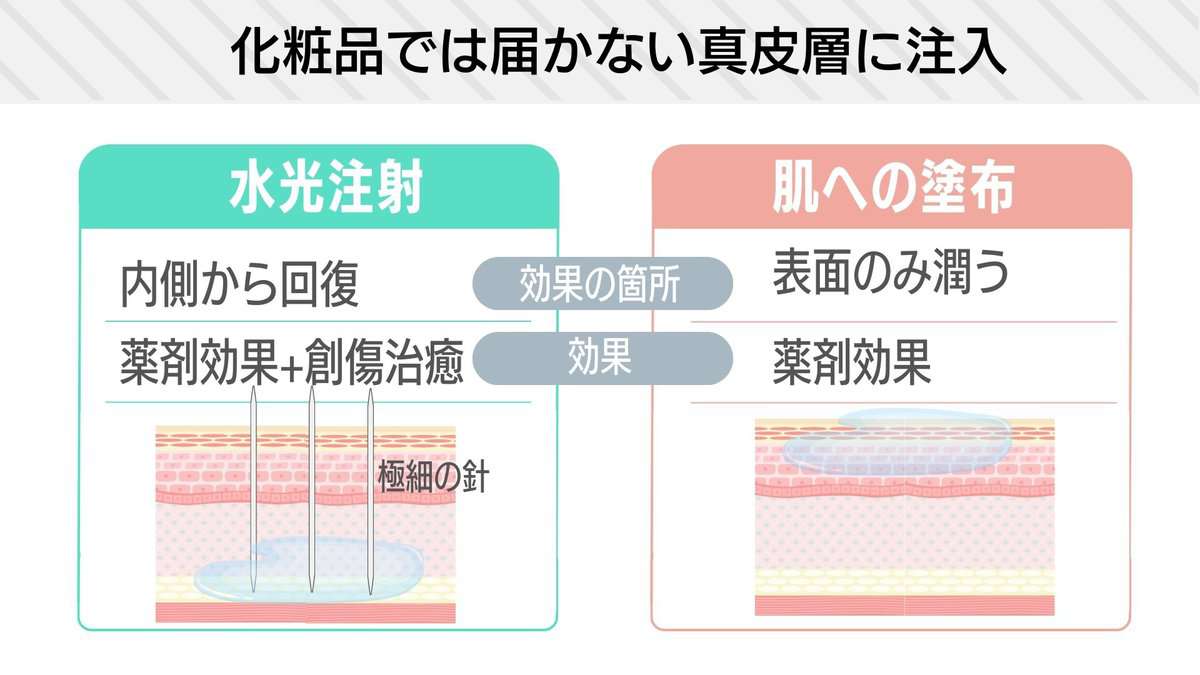 水光注射は皮膚を健康な状態にすることが目的