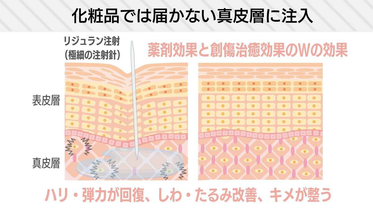 リジュランとは？仕組みと効果