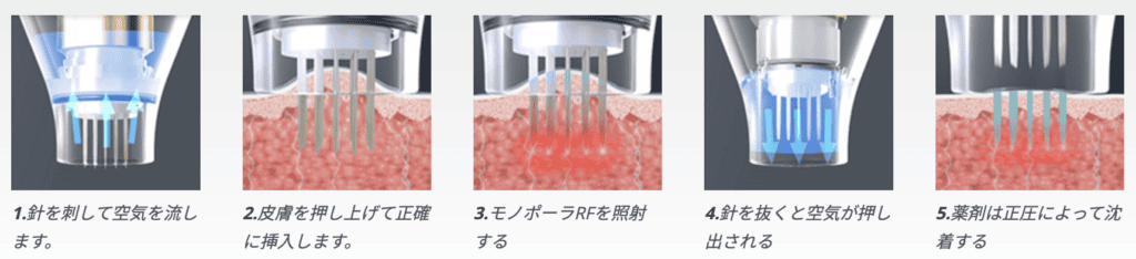 ポテンツァとは