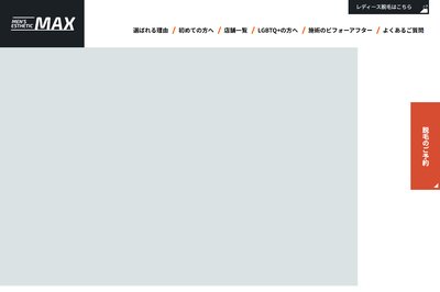 脱毛MAXの外観