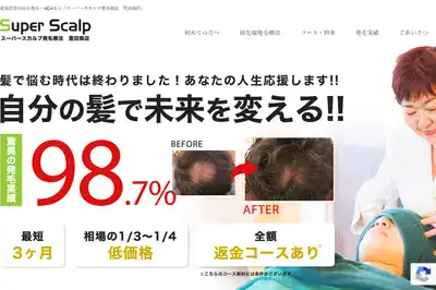 スーパースカルプ発毛療法 豊田南店